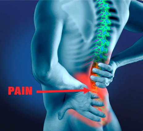 Low Back Pain Google image from http://www.ccarechiro.com/wp-content/uploads/2013/10/763327.jpg