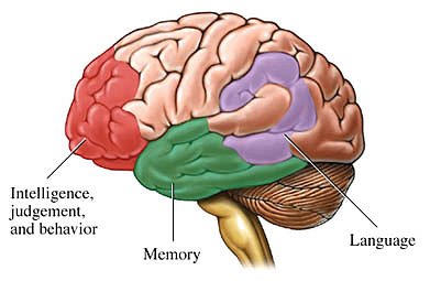 Alheimer's Disease Google image from http://fiveadaythefunway.com/wp-content/uploads/2010/11/alzheimers.jpg