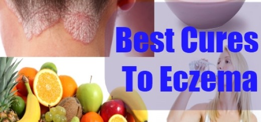 Best Cures to Eczema Google image from http://cdn.natural-homeremedies.com/fitness/wp-content/uploads/2011/04/Best-Cures-To-Eczema-520x245.jpg