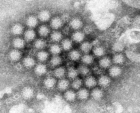 Norovirus Google image from http://images.medicinenet.com/images/government/norovirus.jpg